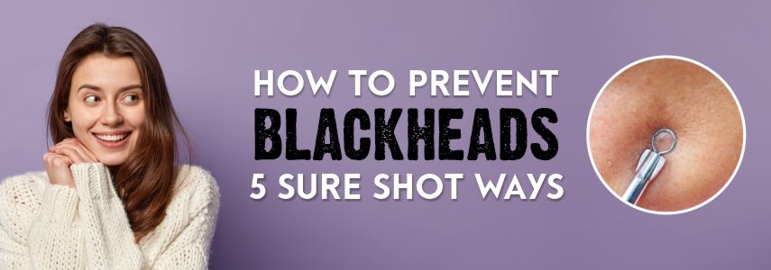 How to Prevent Blackheads: 5 Sure Shot Ways
