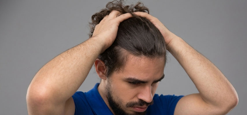 Showing dry scalp
